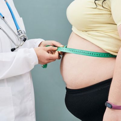 The hidden cost of our huge problem with obesity