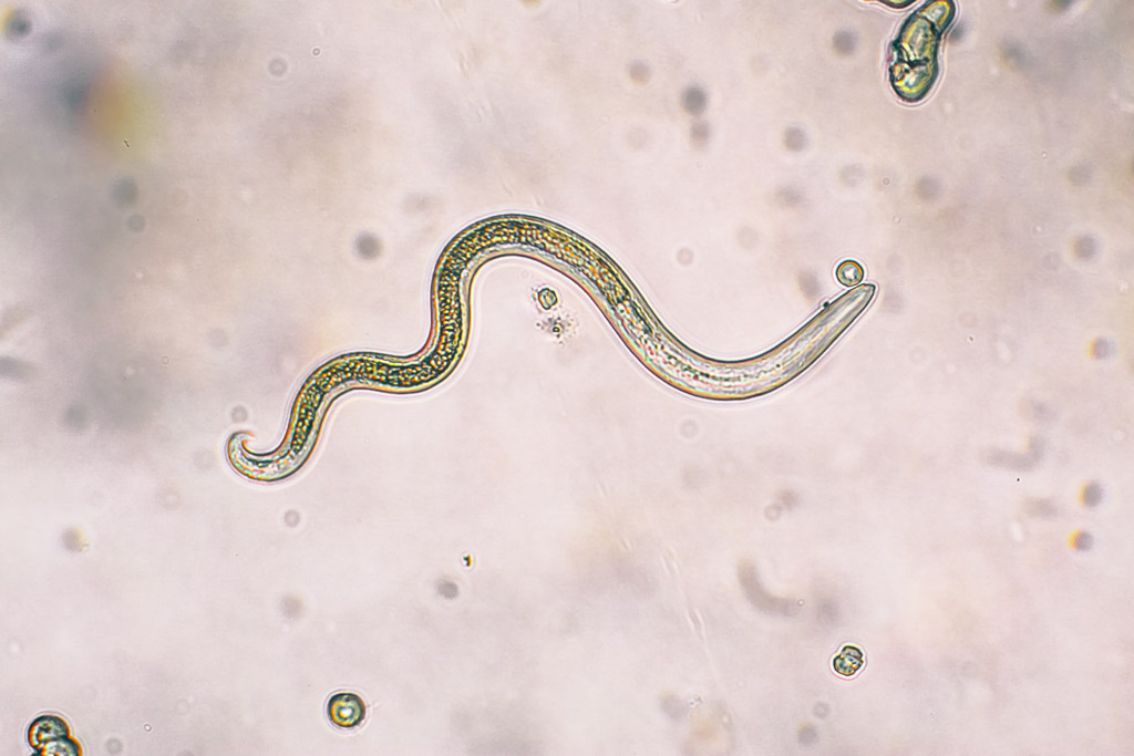 Cryptosporidium and giardia parasites. Phylum aschelminthes képek