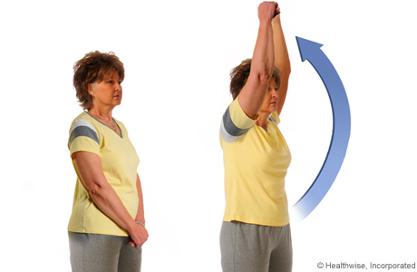 How to do the overhead-reach exercise How to do the overhead-reach exercise