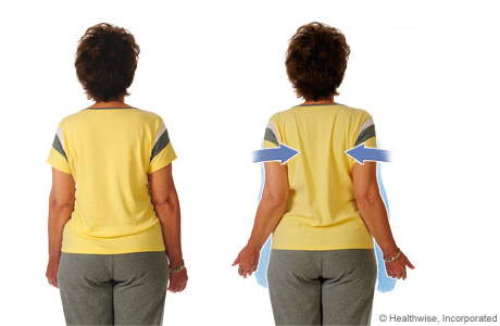 How to do the shoulder-pinch exercise How to do the shoulder-pinch exercise