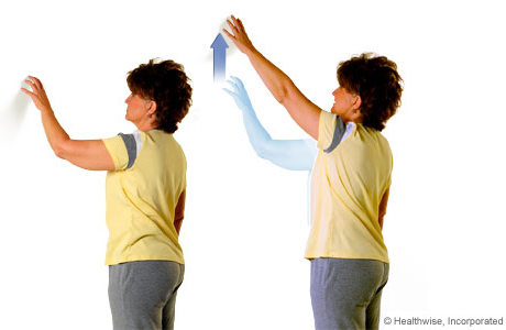 How to do the wall-climb exercise How to do the wall-climb exercise