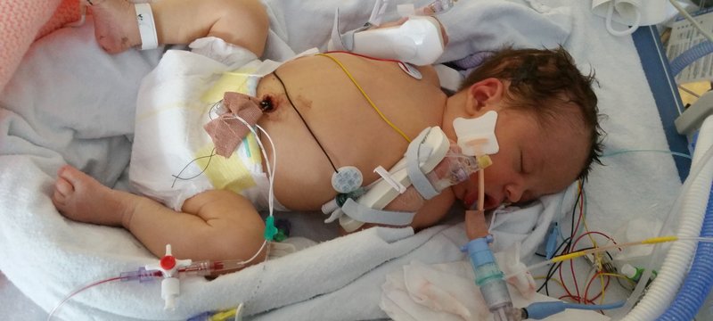 CLINICAL OVERVIEW OF NEONATAL BACTERIAL MENINGITIS: KEY INSIGHTS AND UNDERSTANDING