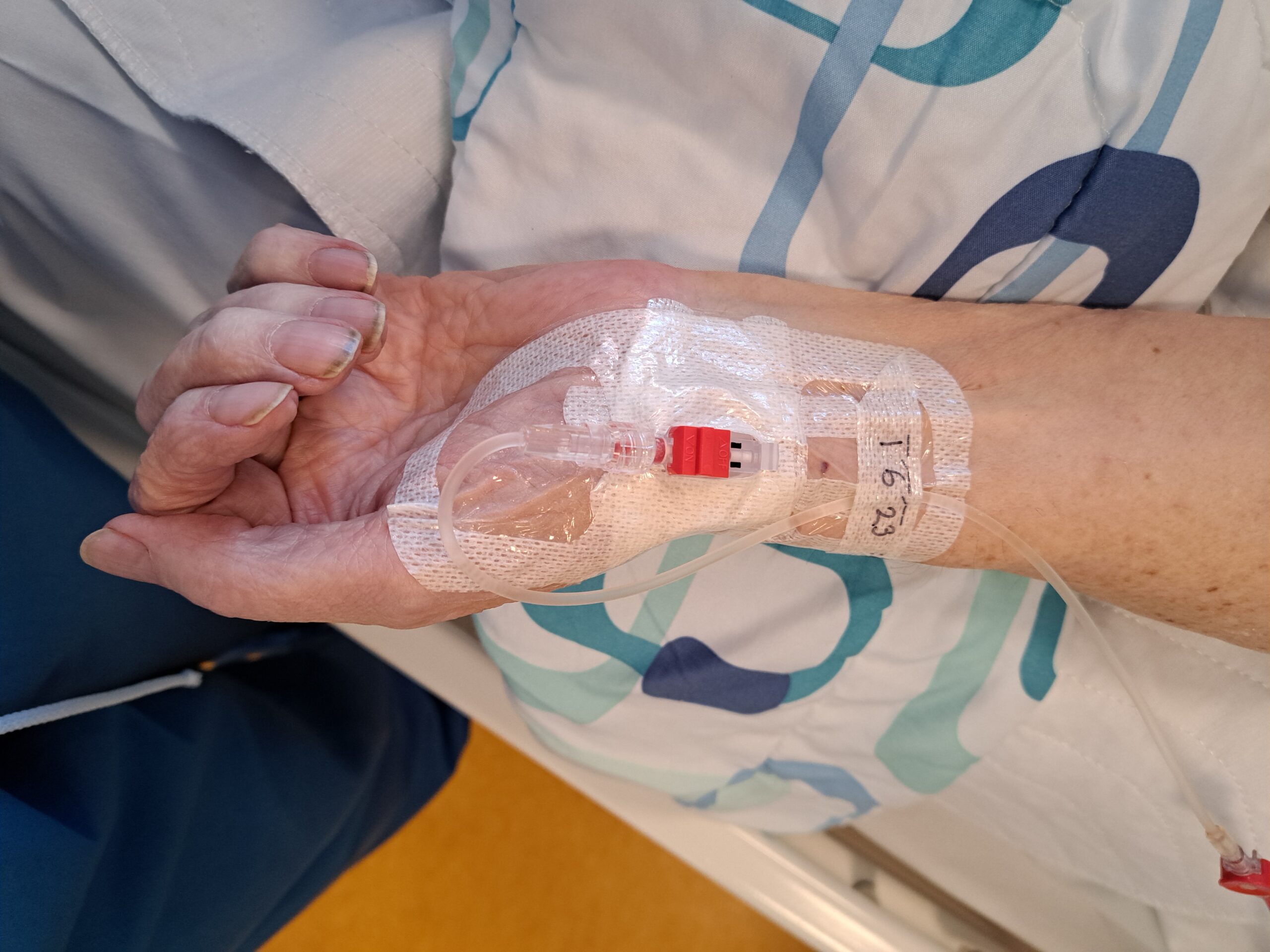 BEST PRACTICES FOR INSERTING AN ARTERIAL CATHETER INTO THE RADIAL ARTERY