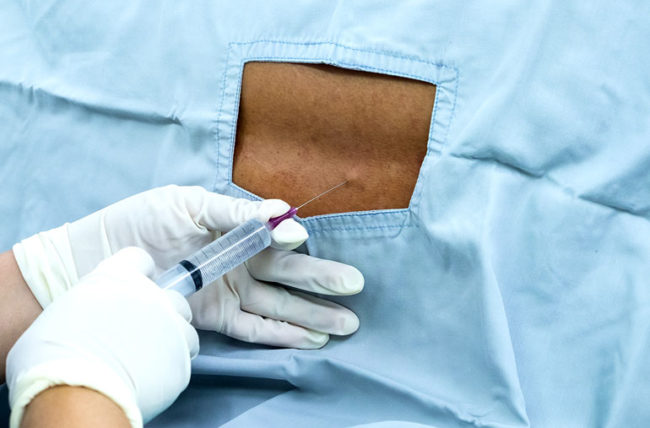 ADJUVANT MEDICATIONS FOR PERIPHERAL NERVE BLOCKS: ENHANCING EFFICACY AND SAFETY