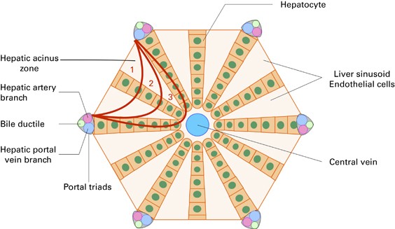 A COMPLETE CLINICAL GUIDE TO SINUSOIDAL OBSTRUCTION SYNDROME