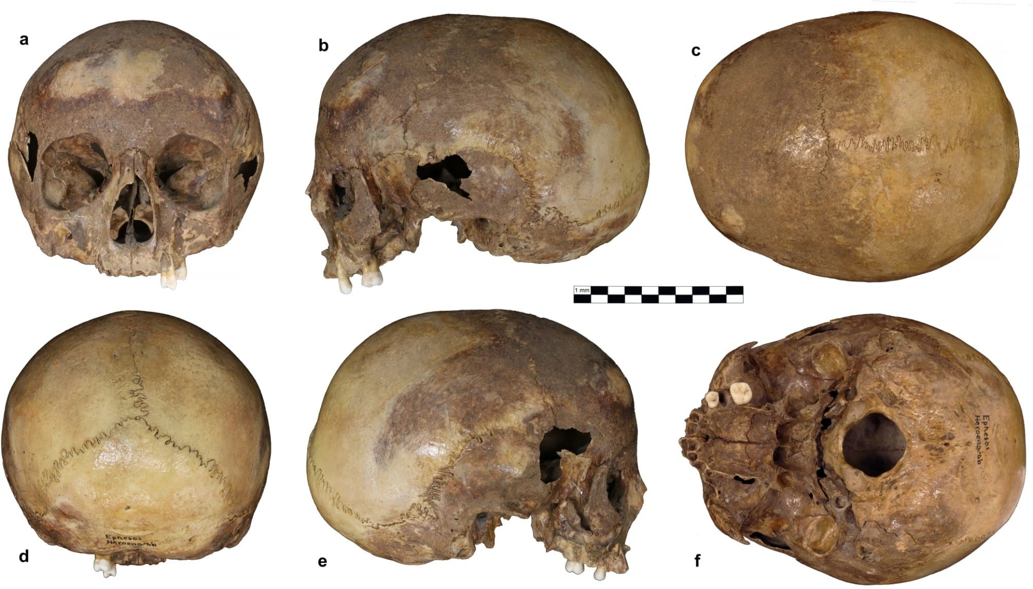 Analysis-of-Ephesus-Skull-Confirms