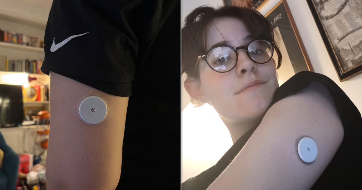 I-Tracked-My-Blood-Sugar