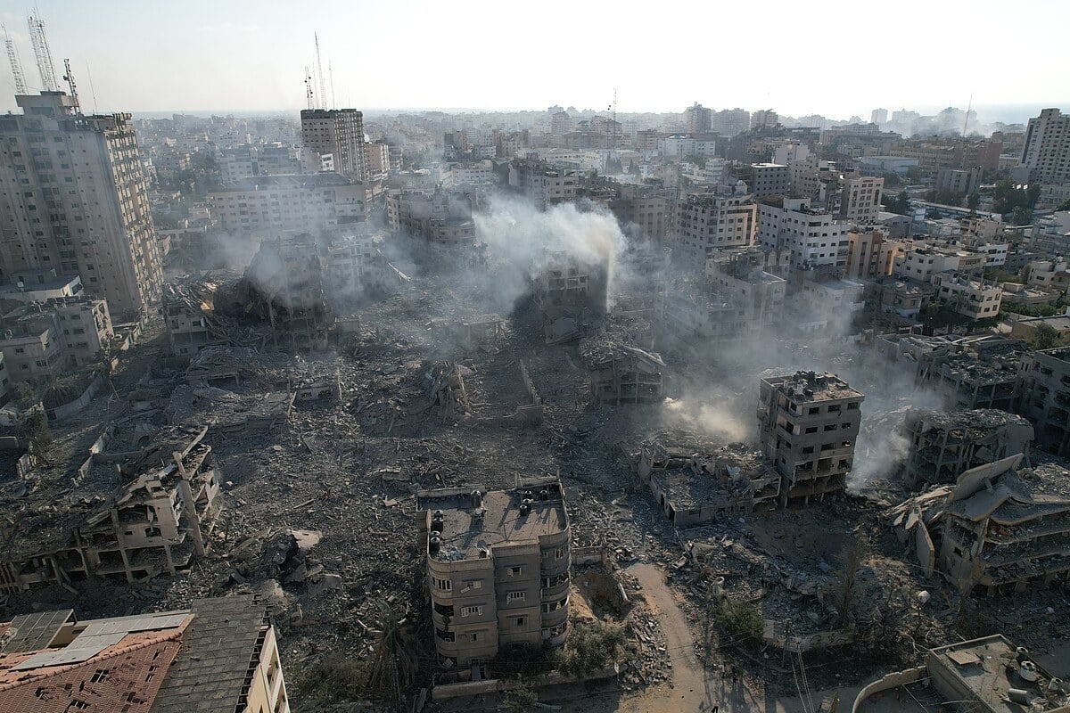 Image-of-Amputated-Gaza-Boy