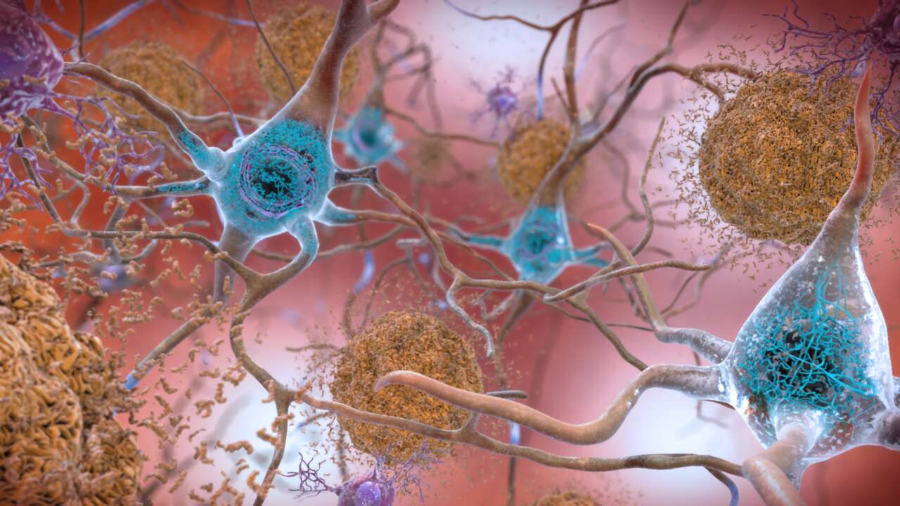 Scientists-Restore-Key-Alzheimers-Pathway