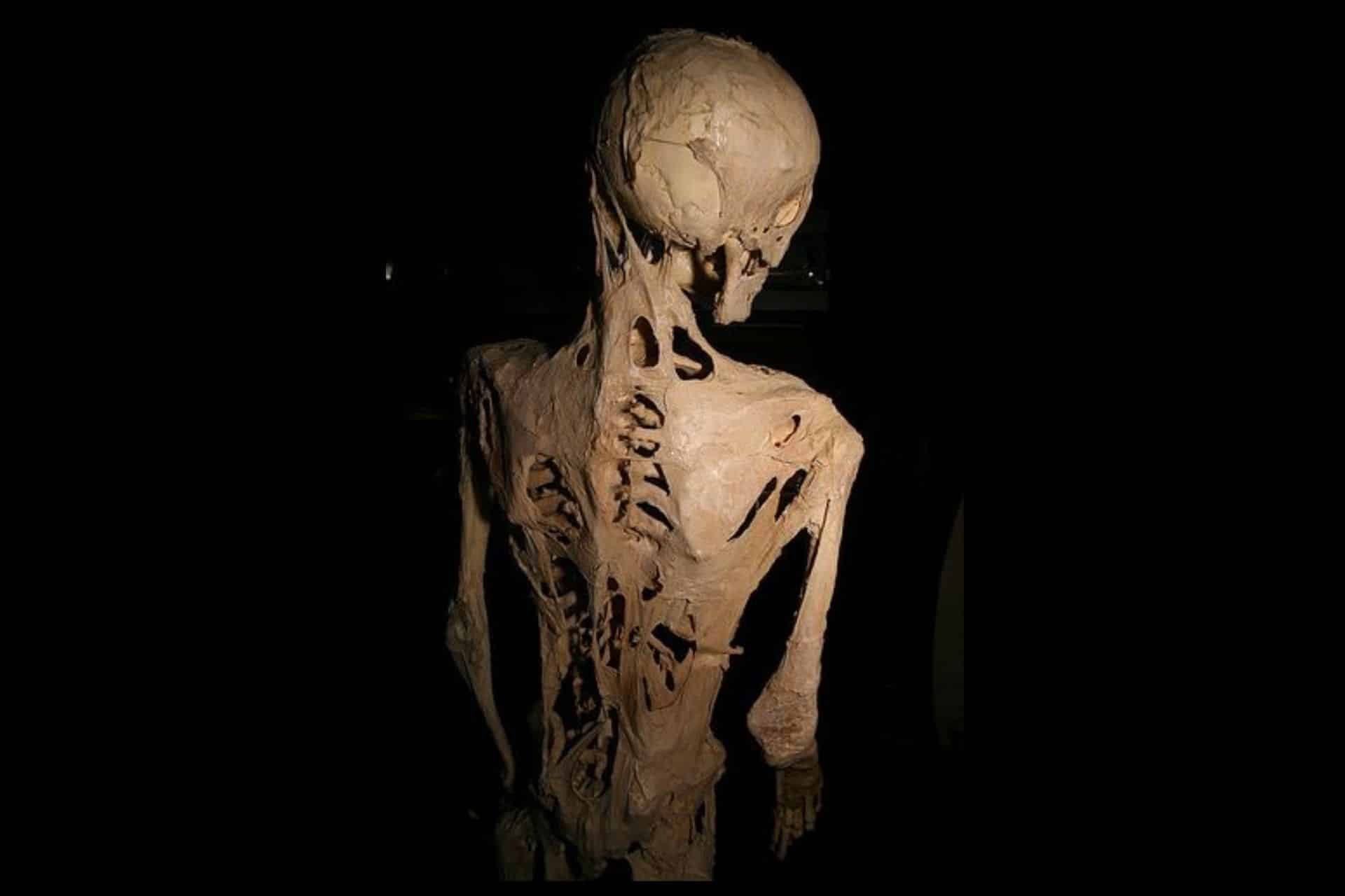 The-Rare-Condition-Where-the