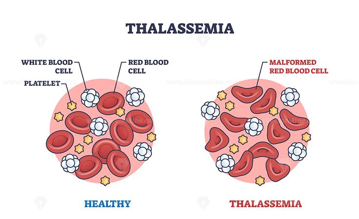 THALASSEMIA IN CHILDREN: COMPREHENSIVE ASSESSMENT AND MANAGEMENT TECHNIQUES