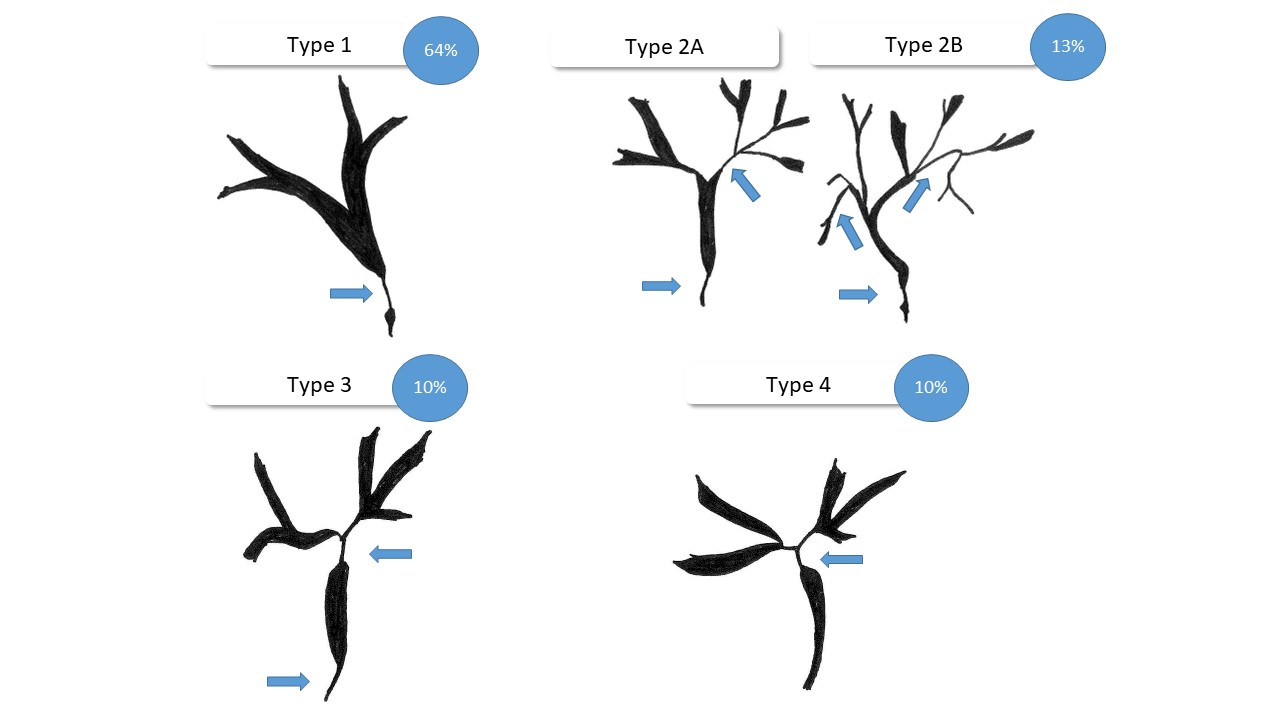 MANAGING IGG4-RELATED SCLEROSING CHOLANGITIS: INSIGHTS AND STRATEGIES FOR CLINICIANS