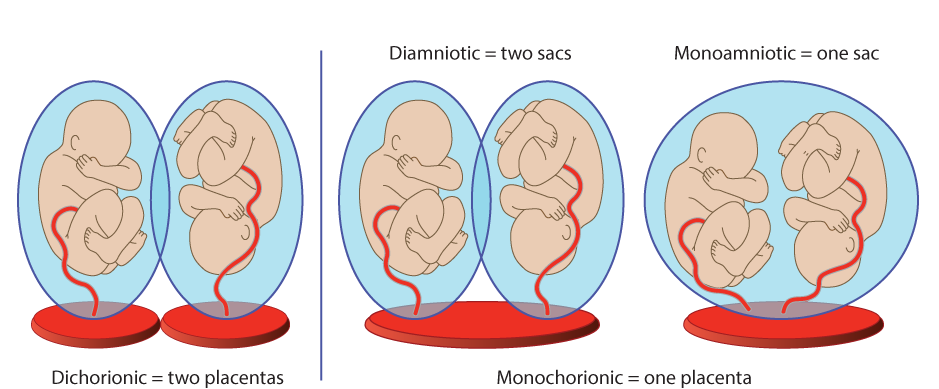 MULTIFETAL GESTATION: ESSENTIAL INFORMATION FOR EXPECTING PARENTS