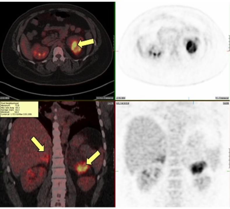 A DETAILED GUIDE TO CONGENITAL ADRENAL HYPERPLASIA FROM 21-HYDROXYLASE DEFICIENCY