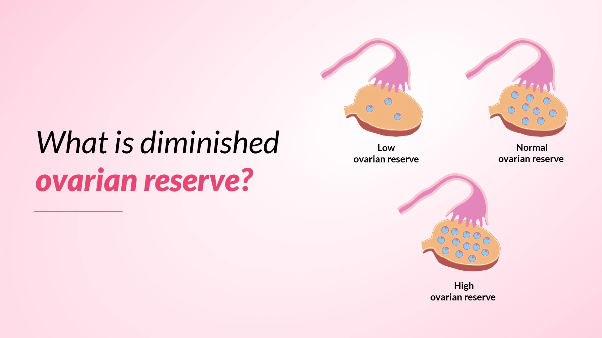 DIMINISHED OVARIAN RESERVE: EXPERT TIPS FOR IMPROVED FERTILITY