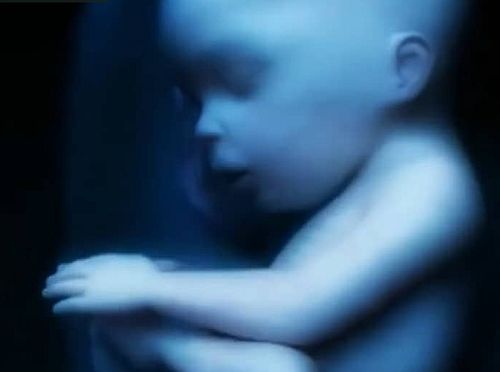 29-afxisi-stis-amvlosis-sta 29% αύξηση στις αμβλώσεις στα κορίτσια κάτω των 16 ετών στη Σκωτία, μέσα στο 2023