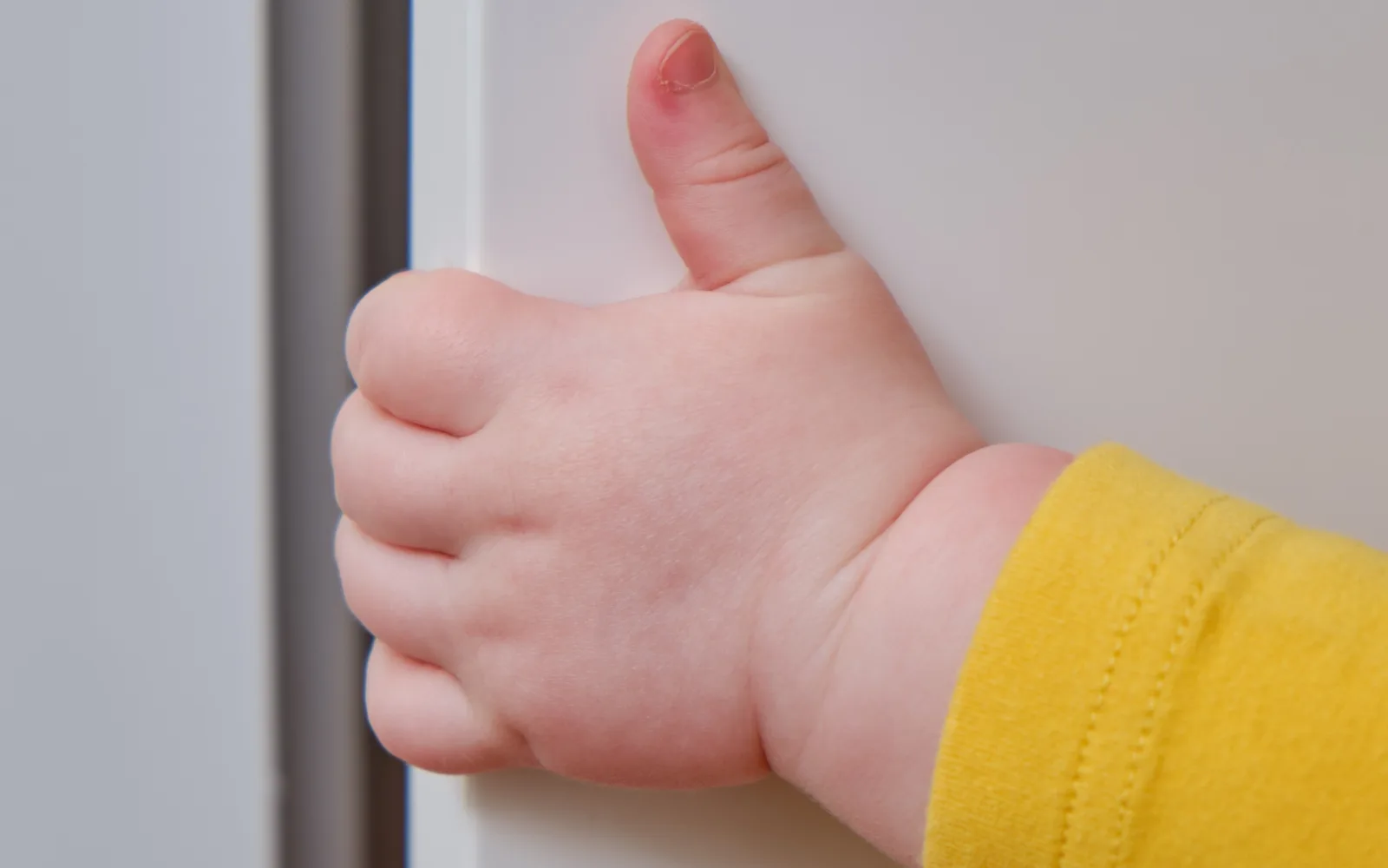 piastike-to-cheraki-tou-stin Πιάστηκε το χεράκι του στην πόρτα; Πώς προλαμβάνουμε αιματώματα και κατάγματα