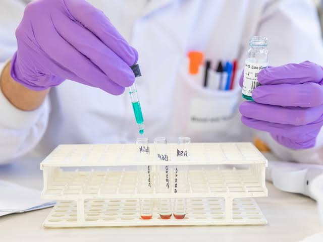 ABO COMPATIBILITY AND TISSUE TYPING IN ORGAN TRANSPLANTATION