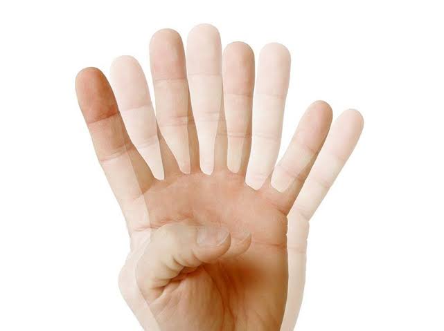 A CLINICIAN’S GUIDE TO DIPLOPIA AND CRANIAL NERVE PALSIES