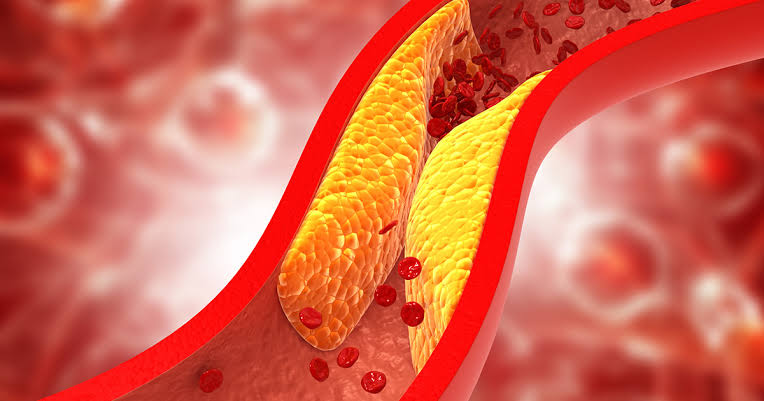 FATE OF DIETARY CHOLESTEROL AND INDIGENOUS CHOLESTEROL IN HUMAN BODY