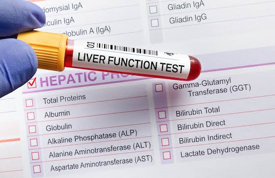 CRUCIAL FACTS YOU NEED TO KNOW ABOUT LIVER FUNCTION TESTS