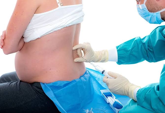 COMPREHENSIVE OVERVIEW OF ANALGESIA AND ANESTHESIA IN OBSTETRICS