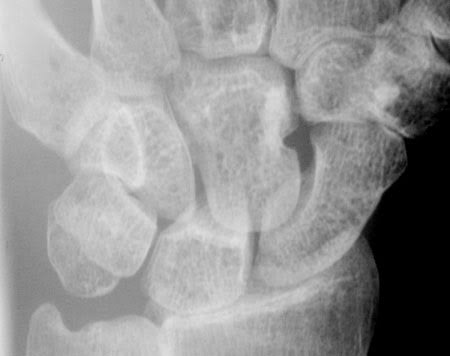 THE SCIENCE BEHIND MACRO-RADIOGRAPHY TECHNIQUES