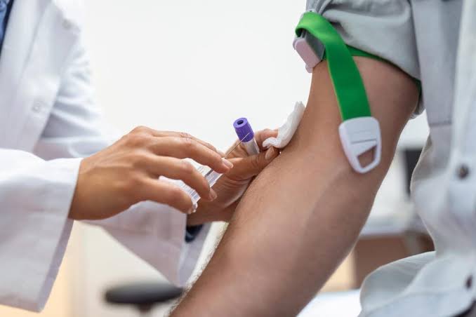 HOW TO INTERPRET TOTAL LEUKOCYTE COUNT RESULTS