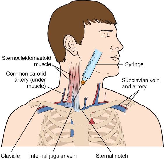 PRINCIPLES OF FLUID THERAPY IN THE PREOPERATIVE PERIOD