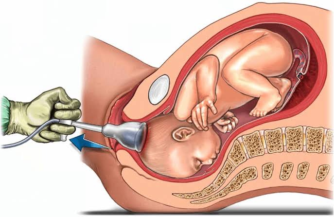 PRINCIPLES OF OPERATIVE VAGINAL DELIVERY: EFFECTIVE TECHNIQUES AND APPROACHES