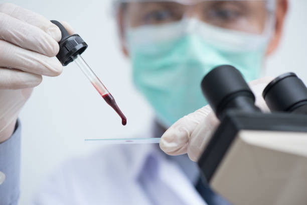 DETECTION OF PLASMODIUM PATHOGEN USING PERIPHERAL SMEAR