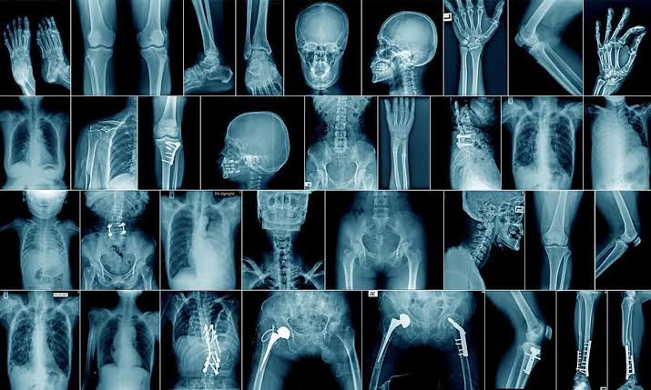 HOW RADIOGRAPHIC IMAGES ARE FORMED: A SCIENTIFIC EXPLORATION
