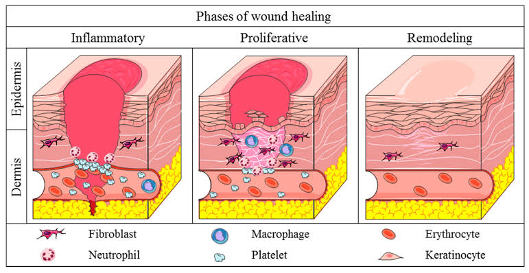 INFLAMMATION AND REPAIR