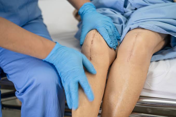 HEALING TIMES FOR SURGICAL WOUNDS AND COMMON ISSUES