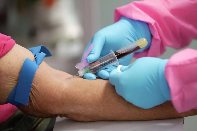 BLOOD CULTURE METHODS TO IDENTIFY BLOODSTREAM INFECTIONS