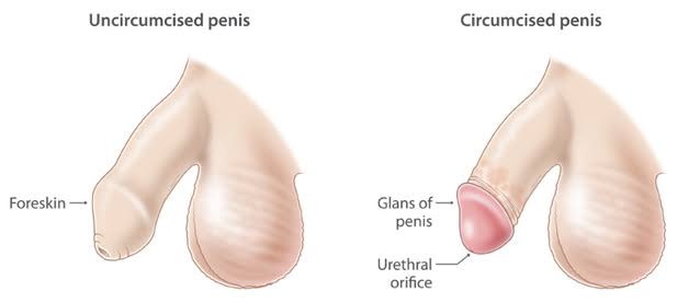 CIRCUMCISION FACTS EVERY PARENT SHOULD KNOW