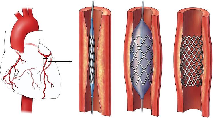CARDIAC INTERVENTIONS IN CARDIOLOGY PRACTICES: TYPES, METHODS, AND INDICATIONS