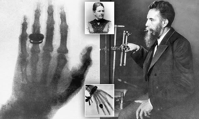 THE HISTORY OF X-RAY DISCOVERY AND HOW IT CHANGED MEDICINE