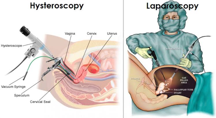 PREPARING FOR SURGERY: WHAT YOU NEED TO KNOW ABOUT GYNAECOLOGICAL PROCEDURES