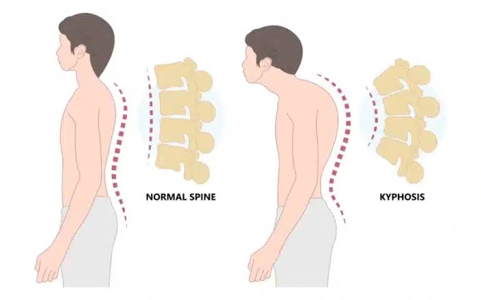 COMMON CHEST WALL ABNORMALITIES AND THEIR SYMPTOMS