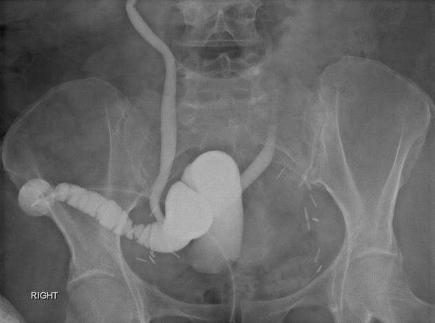 HOW LOOPOGRAM IS REVOLUTIONIZING IMAGING TECHNIQUES IN RADIOLOGY