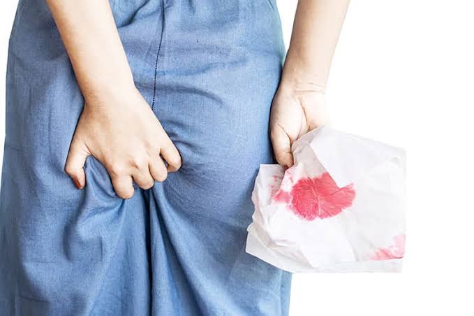 CHANGE IN BOWEL HABIT AND CAUSES OF RECTAL BLEEDING