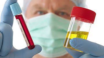 TOP STRATEGIES FOR EFFECTIVE DIAGNOSIS AND MANAGEMENT OF HEMATURIA