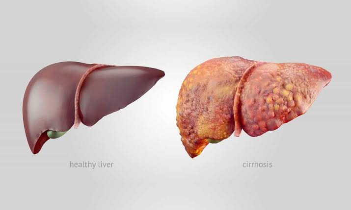INTRODUCTION TO LIVER DISEASES
