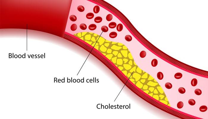 PLASMA LIPOPROTEINS AND CHOLESTEROL