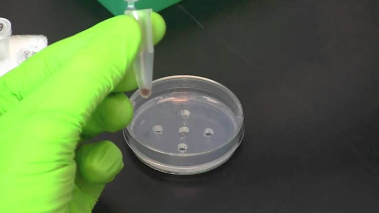 DOUBLE IMMUNODIFFUSION TEST USING SPECIFIC ANTIBODY AND ANTIGEN