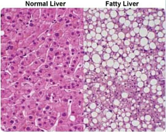 INTRACELLULAR ACCUMULATIONS: CAUSES AND THEIR ROLE IN CELLULAR METABOLIC DERANGEMENTS