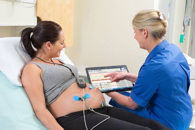 MECHANISM OF LABOR AND CARDIOTOCOGRAPHY