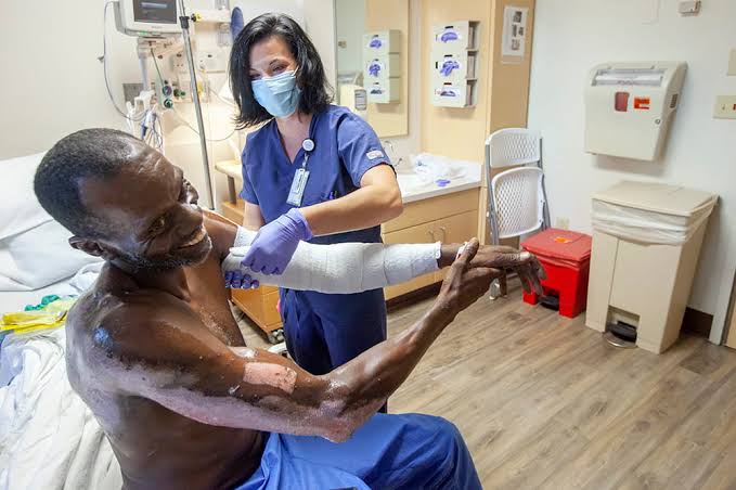 TOP FIRST AID STEPS FOR BURN VICTIMS