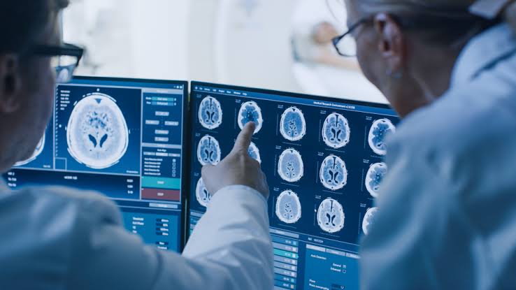 NEUROANATOMY AND NEURORADIOLOGY EXPLAINED